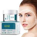 Acne Treatment Cream