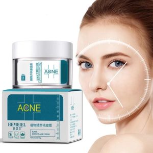 Acne Treatment Cream
